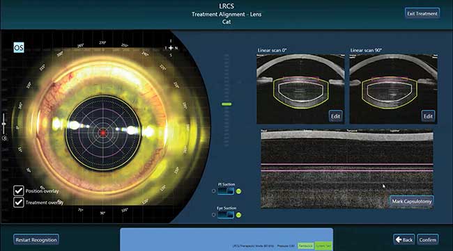 femtosecond laser