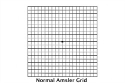 Free Printable Amsler Grid Test PDF Normal Amsler Grid