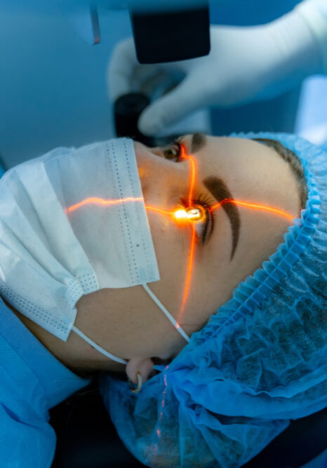Laser Cataract Surgery Laser Cataract Surgery