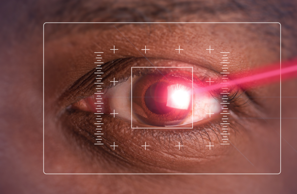 LASIK Eye Surgery Procedure