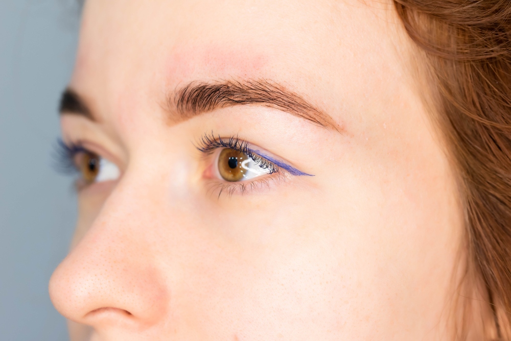 How to Prevent Glaucoma
