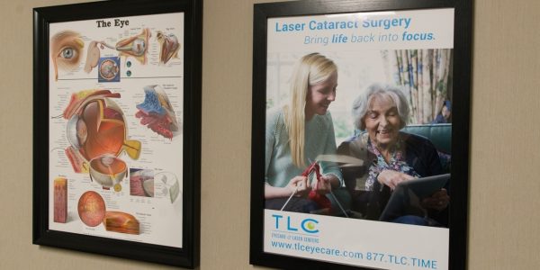 Laser Cataract Surgery