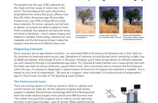 Femtosecond Laser Cataract Surgery