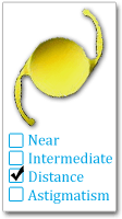 Monofocal Cataract Lens Option